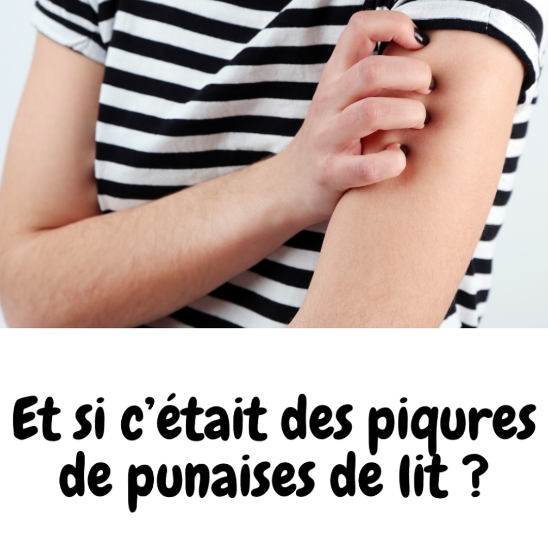 femme qui se gratte le bras car elle a des boutons de punaises de lit